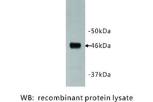 Image no. 1 for anti-Dachsous 1 (DCHS1) antibody (ABIN1112924) (DCHS1 Antikörper)