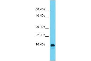 Host: Rabbit  Target Name: RGD1561459  Sample Tissue: Rat Testis lysates  Antibody Dilution: 1. (AAMDC Antikörper  (N-Term))