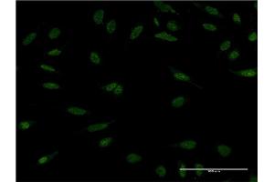 Immunofluorescence (IF) image for anti-Protein Phosphatase, Mg2+/Mn2+ Dependent, 1A (PPM1A) (AA 1-382) antibody (ABIN519084)
