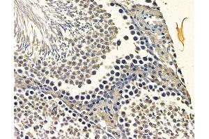 ABIN7096864 and ABIN7100930 at 1/100 staining rat testis tissue by IHC-P.