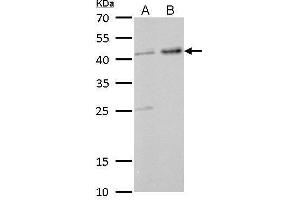 WB Image GNAS antibody [C2C3-2], C-term detects GNAS protein by Western blot analysis. (GNAS Antikörper)