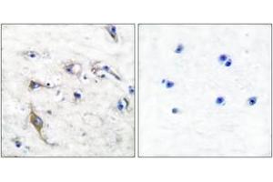 Immunohistochemistry analysis of paraffin-embedded human brain tissue, using JM4 Antibody. (PRAF2 Antikörper  (AA 129-178))
