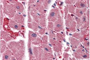 Immunohistochemistry (IHC) image for anti-Inositol 1,4,5-Trisphosphate Receptor, Type 2 (ITPR2) (Internal Region) antibody (ABIN185540)