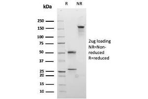 SDS-PAGE Analysis Purified Desmocollin-2/3 Recombinant Mouse Monoclonal Ab (rDSC2/3437). (Rekombinanter Desmocollin 2 Antikörper)