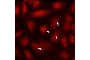 Immunofluorescence (IF) image for anti-Tubulin, beta 2B (TUBB2B) antibody (ABIN567612) (TUBB2B Antikörper)
