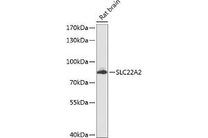 Western blot analysis of extracts of rat brain, using SLC22 antibody (ABIN6129480, ABIN6147887, ABIN6147889 and ABIN6224517) at 1:1000 dilution. (SLC22A2 Antikörper  (AA 44-140))