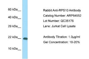 Western Blotting (WB) image for anti-Ribosomal Protein S10 (RPS10) (C-Term) antibody (ABIN2789874) (RPS10 Antikörper  (C-Term))