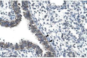 Human Lung (CCRN4L Antikörper  (N-Term))
