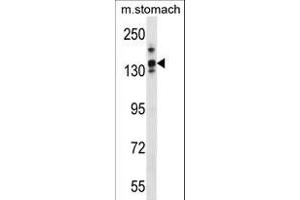 LRRC16A Antikörper  (C-Term)