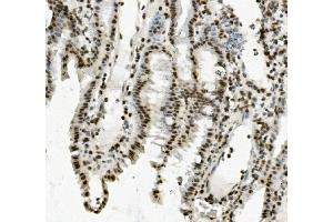 IHC analysis of PRDM5 using anti-PRDM5 antibody (ABIN7600853). (PRDM5 Antikörper  (AA 24-630))