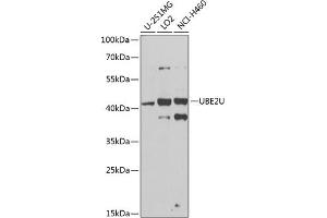 Western blot analysis of extracts of various cell lines, using UBE2U antibody (ABIN6130858, ABIN6149825, ABIN6149826 and ABIN6224418) at 1:1000 dilution. (UBE2U Antikörper  (AA 1-226))