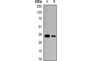 Western blot analysis of CDK6 expression in Jurkat (A), K562 (B) whole cell lysates. (CDK6 Antikörper)