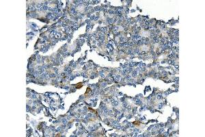 IHC analysis of CCNB2 using anti-CCNB2 antibody (ABIN7600750).