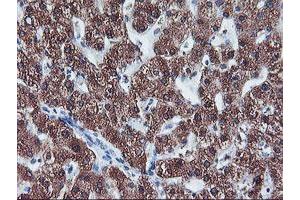 Immunohistochemistry (IHC) image for anti-Cytochrome P450, Family 2, Subfamily A, Polypeptide 6 (CYP2A6) antibody (ABIN1497724)