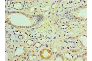 Immunohistochemistry of paraffin-embedded human kidney tissue using ABIN7161898 at dilution of 1:100 (NR1I3 Antikörper  (AA 2-351))