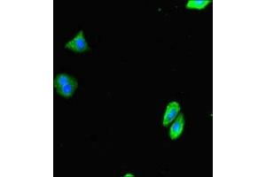 Immunofluorescent analysis of HepG2 cells using ABIN7151017 at dilution of 1:100 and Alexa Fluor 488-congugated AffiniPure Goat Anti-Rabbit IgG(H+L) (Deltex Homolog 4 Antikörper  (AA 167-432))