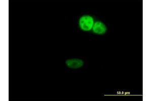Immunofluorescence of purified MaxPab antibody to ZNF124 on HeLa cell. (ZNF124 Antikörper  (AA 1-289))