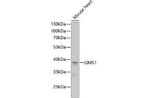 Western blot analysis of extracts of mouse heart, using LIMS1 antibody (ABIN6132048, ABIN6143232, ABIN6143234 and ABIN6218088) at 1:1000 dilution. (LIMS1 Antikörper  (AA 1-325))