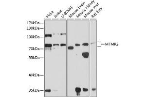 Western blot analysis of extracts of various cell lines, using MTMR2 antibody (ABIN6128322, ABIN6144156, ABIN6144157 and ABIN6224847) at 1:1000 dilution. (MTMR2 Antikörper  (AA 404-643))