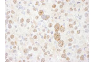 Immunohistochemistry (IHC) image for anti-Proteasome (Prosome, Macropain) 26S Subunit, ATPase, 2 (PSMC2) (AA 150-200) antibody (ABIN7454964)