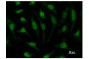 Immunostaining analysis in HeLa cells. (RUVBL1 Antikörper)