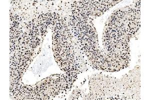IHC analysis of DBC-1/CCAR2 using anti-DBC-1/CCAR2 antibody (ABIN7602235).