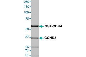 Image no. 2 for Cyclin-Dependent Kinase 4 (CDK4) (AA 4-303) (Active) protein (His tag) (ABIN5570012)