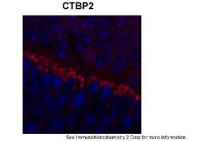 Sample Type: outer mouse plexiform layerRed: PrimaryBlue: DAPIPrimary Dilution: 1:200Secondary Antibody: Goat anti-Rabbit AF568 IgG(H+L)Secondary Dilution: 1:200Image Submitted by: David ZenisekYale University