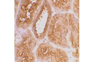 Immunohistochemical staining of human kidney tissue using AP30007PU-N ACE2 antibody at 2 μg/ml. (ACE2 Antikörper  (C-Term))