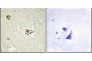 Immunohistochemistry (IHC) image for anti-Cytochrome P450, Family 19, Subfamily A, Polypeptide 1 (CYP19A1) (AA 221-270) antibody (ABIN1534373)
