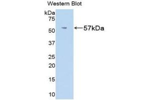 Western Blotting (WB) image for Fibrinogen beta Chain (FGB) ELISA Kit (ABIN6720509)