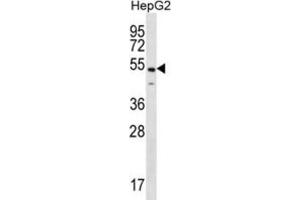 Western Blotting (WB) image for anti-NFKB Activating Protein (NKAP) antibody (ABIN2996720) (NKAP Antikörper)