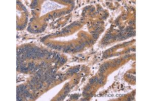 Immunohistochemistry of Human brain  using S100A13 Polyclonal Antibody at dilution of 1:40 (S100A13 Antikörper)