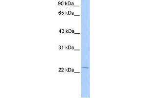 Human Placenta; WB Suggested Anti-C5orf39 Antibody Titration: 0.