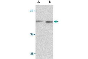 Western blot analysis of NANOS1 in rat brain tissue lysate with NANOS1 polyclonal antibody  at (A) 1 and (B) 2 ug/mL . (Nanos Homolog 1 Antikörper  (Internal Region))