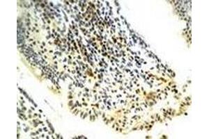 Immunohistochemiacl staining of rat model of Necrotizing Enterocolitis (NEC) tissue section with PNOC polyclonal antibody  at 1:400 dilution. (PNOC Antikörper)