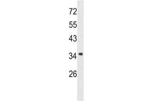 Western Blotting (WB) image for anti-Annexin A1 (ANXA1) (AA 129-158) antibody (ABIN3029969)