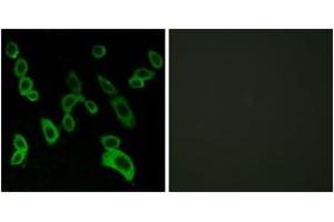Immunofluorescence analysis of LOVO cells, using GPR139 Antibody. (GPR139 Antikörper  (AA 181-230))
