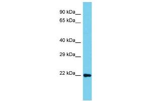 Host: Rabbit Target Name: C8orf33 Sample Type: Jurkat Whole Cell lysates Antibody Dilution: 1. (C8orf33 Antikörper  (C-Term))
