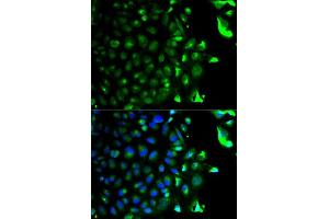 Immunofluorescence analysis of HeLa cells using RAB5A antibody (ABIN5970526). (RAB5 Antikörper)