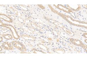 Detection of GSTM1 in Human Kidney Tissue using Polyclonal Antibody to Glutathione S Transferase Mu 1 (GSTM1) (GSTM1 Antikörper  (AA 1-218))