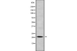 Western blot analysis of RABL5 using A549 whole cell lysates (RABL5 Antikörper  (Internal Region))