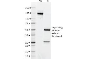 SDS-PAGE Analysis Purified BCL-6 Mouse Monoclonal Antibody (BCL6/1718). (BCL6 Antikörper  (AA 256-389))