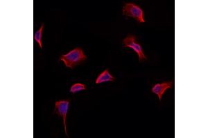 ABIN6265330 and ABIN6273170 staining Hela by IF/ICC. (STBD1 Antikörper  (N-Term))