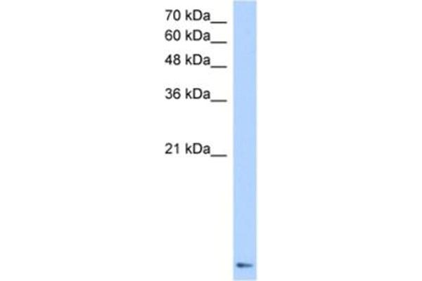ZNF706 Antikörper