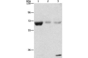 Western Blot analysis of Human fetal muscle, kidney and liver tissue using NAE1 Polyclonal Antibody at dilution of 1:500 (NAE1 Antikörper)