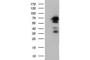 Western Blotting (WB) image for anti-Adenylate Kinase 5 (AK5) antibody (ABIN1496533) (Adenylate Kinase 5 Antikörper)