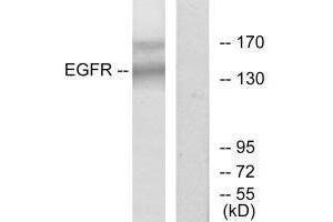 Western blot analysis of extracts from HT-29 cells, using EGFR (Ab-1172) antibody.