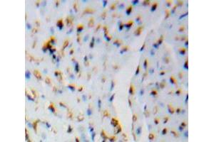 Used in DAB staining on fromalin fixed paraffin-embedded Brain tissue (HSPH1 Antikörper  (AA 388-505))