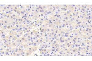 Immunohistochemistry (IHC) image for anti-Hermansky-Pudlak Syndrome 4 (HPS4) (AA 6-192) antibody (ABIN7443911)